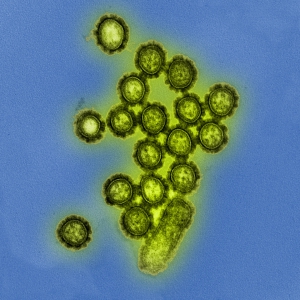 H1N1_Influenza_Virus_Particles_(8411599236)_credit_NIAID_cc-by-20